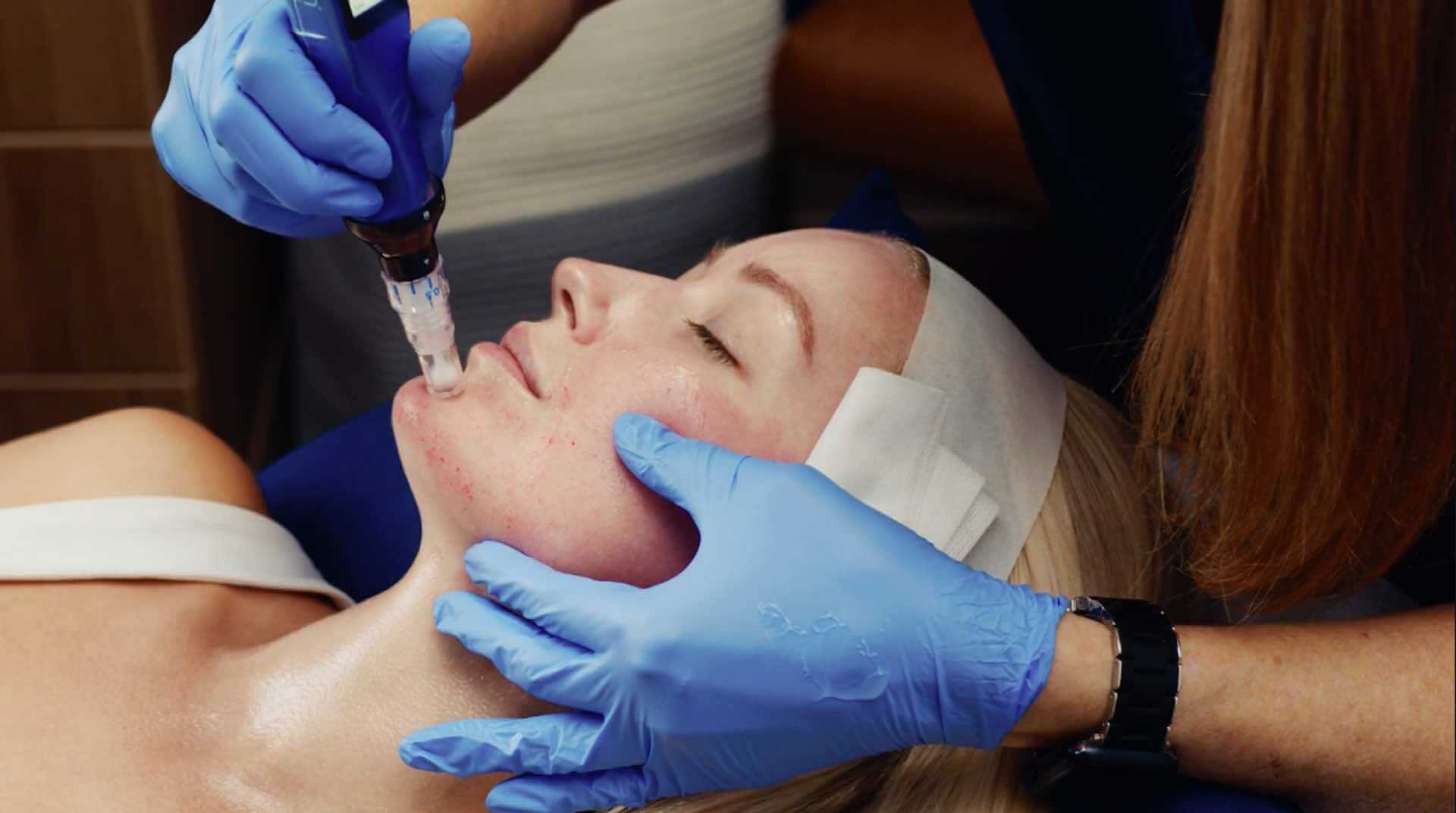 During Treatment